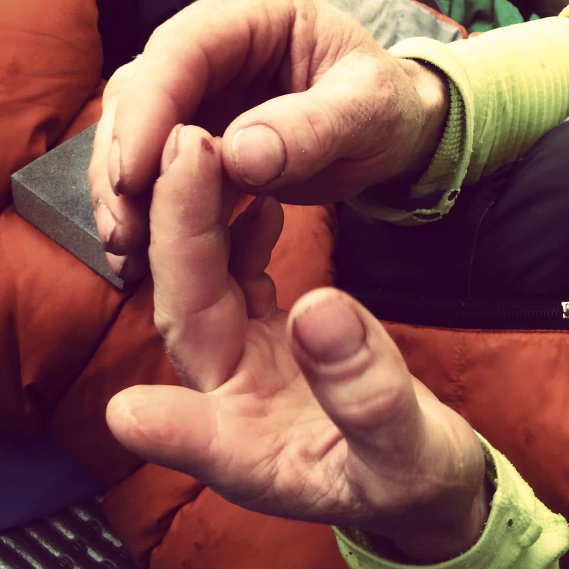Tommy's fingers. Strong looking nub there, TC! Photo: Corey Rich